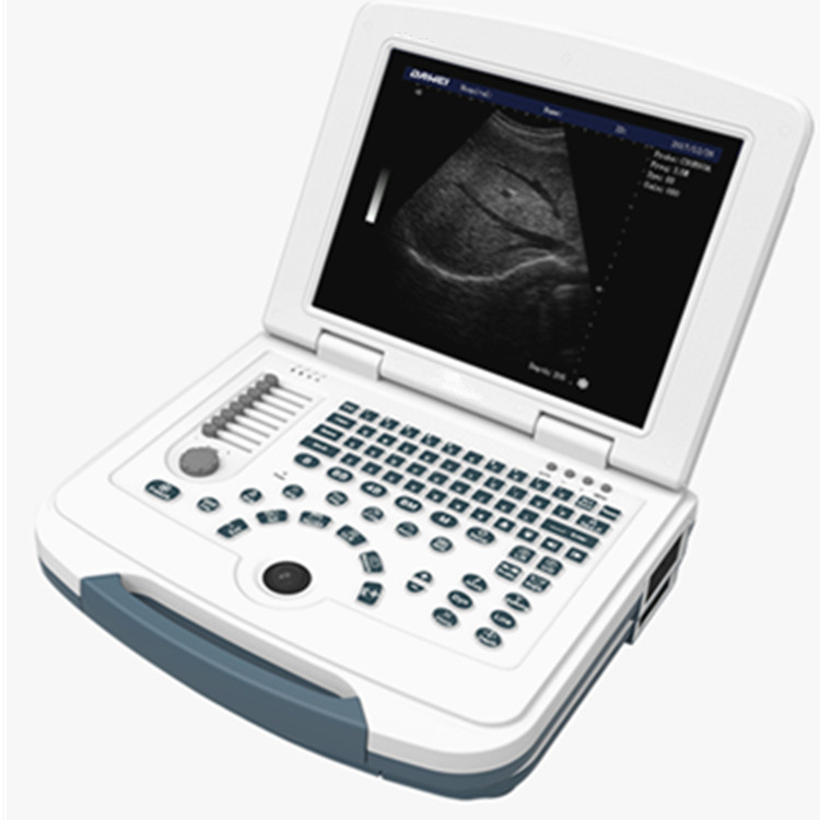 B/W Notebook Ultrasound System Scanner B/W Notebook Ultrasound System Scanner