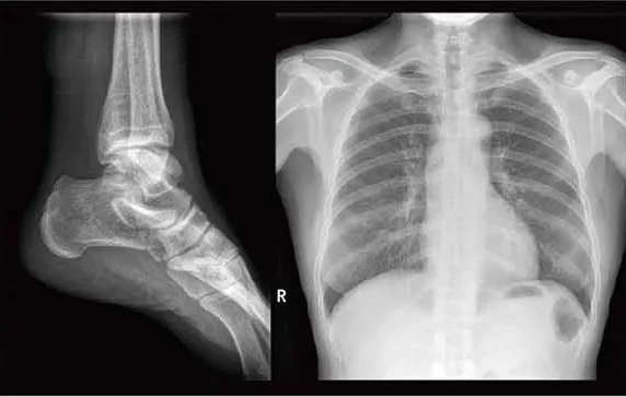xray xray