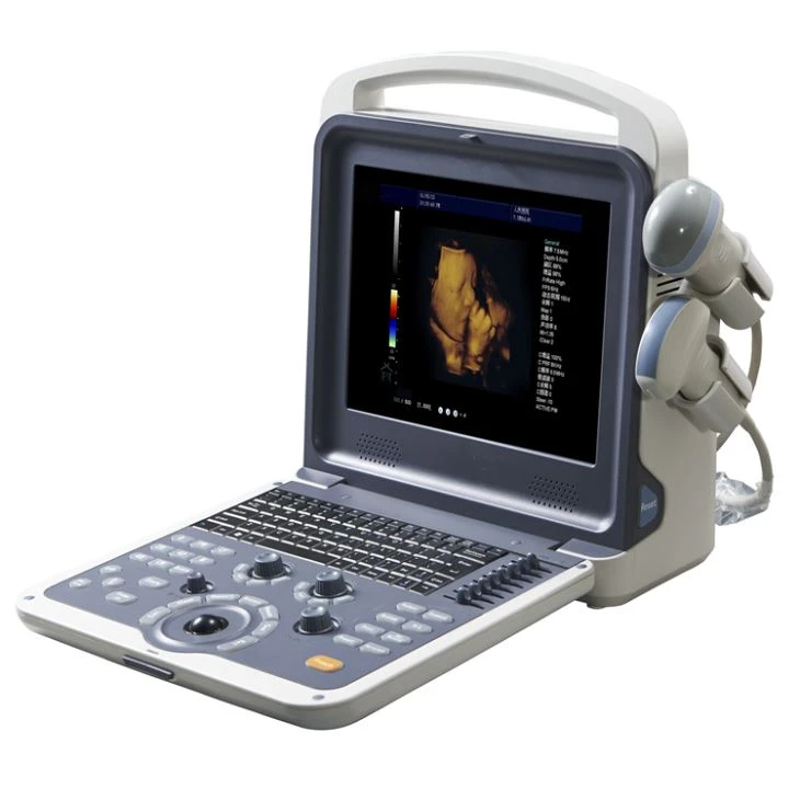 3D Color Digital Notebook Ultrasound Scanner 3D Color Digital Notebook Ultrasound Scanner