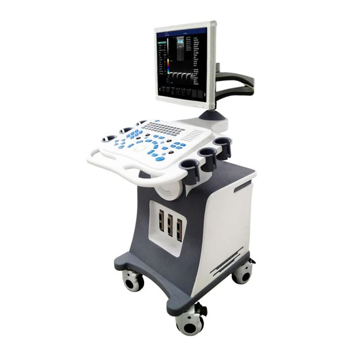 Scanner per ultrasuoni vascolare 4D
