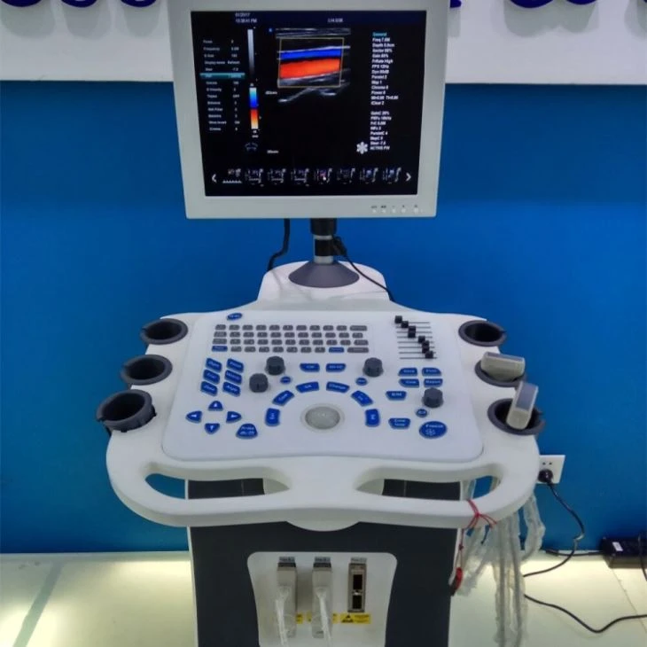 4D Portable Vascular Ultrasound Diagnostic Imaging Systems 4D Portable Vascular Ultrasound Diagnostic Imaging Systems