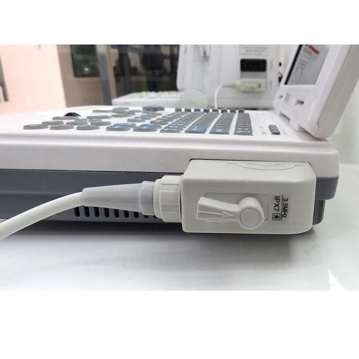 B/W Notebook Ultrasound System Scanner B/W Notebook Ultrasound System Scanner