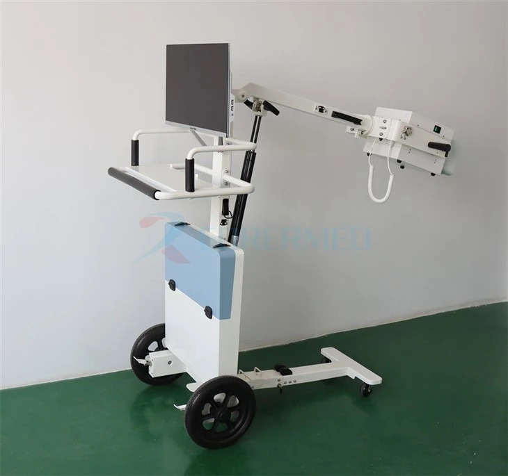Mobile Digital X Ray Machine Mobile Digital X Ray Machine